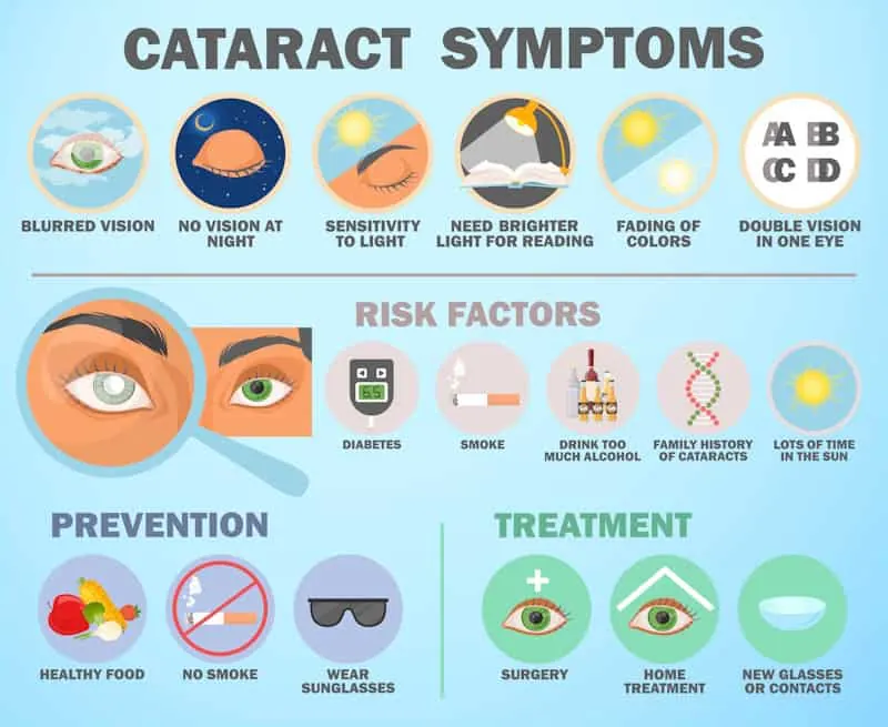 Illustrated guide to cataract symptoms, risk factors, prevention and treatment